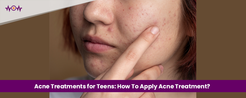 Acne Treatments for Teens: How To Apply Acne Treatment?