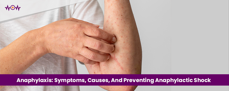 Anaphylaxis: Symptoms, Causes, And Preventing Anaphylactic Shock