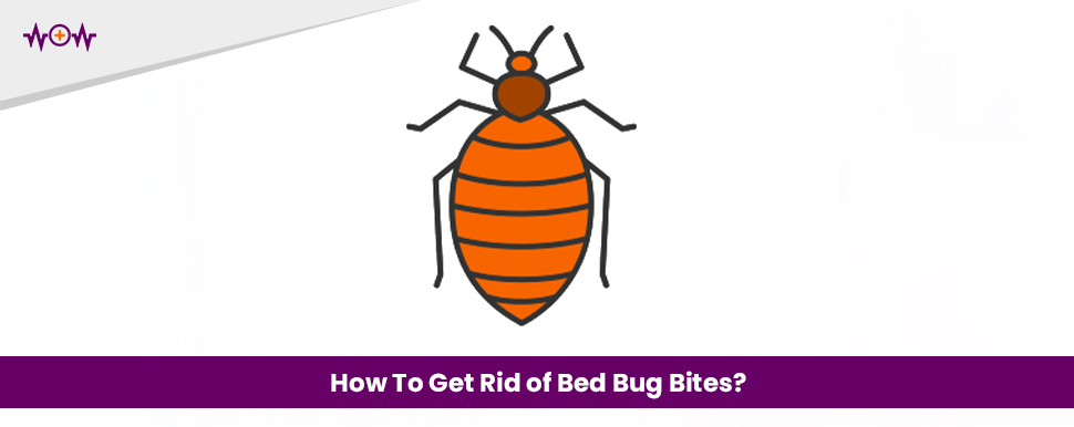 How To Get Rid of Bed Bug Bites?