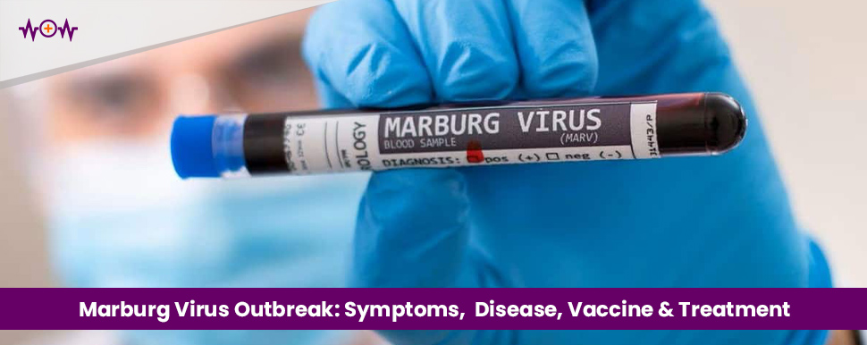 Marburg Virus Outbreak: Symptoms,  Disease, Vaccine & Treatment